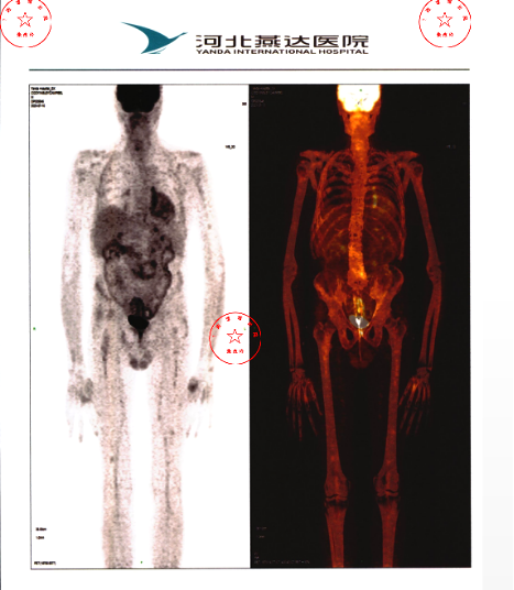 b98b271a771686de4a6406f669155866_1715758689_5412.png b98b271a771686de4a6406f669155866_1715758689_5412.png